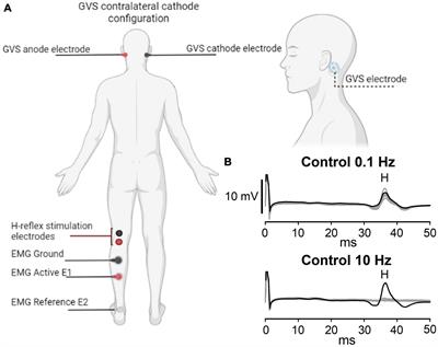 Post-activation depression of the Hoffman reflex is not altered by galvanic vestibular stimulation in healthy subjects